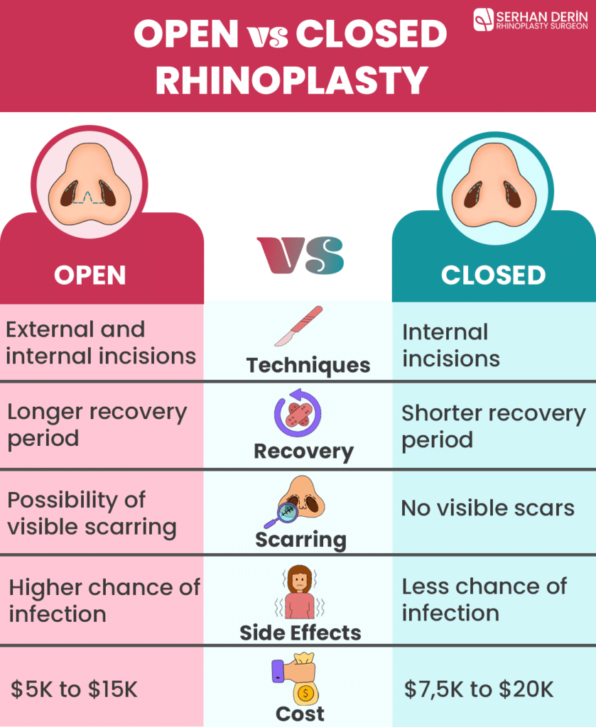 Open vs closed rhinoplasty choosing the right approach Choosing